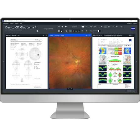 ZEISS FORUM 망막 녹내장 통합 정밀분석 시스템