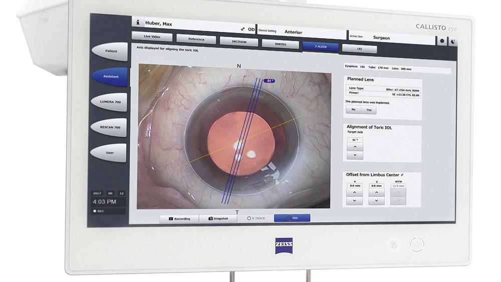 Callisto Eye Zeiss 백내장수술 디지털 네비게이션